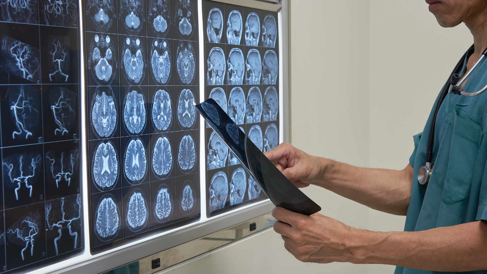 Neurofeedback em Brasília: o que é, como funciona e para quem é